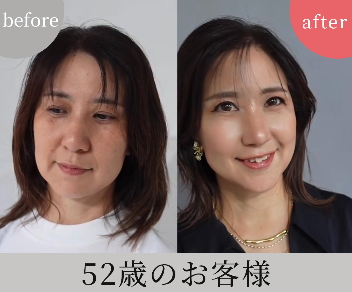 ビフォーアフター1