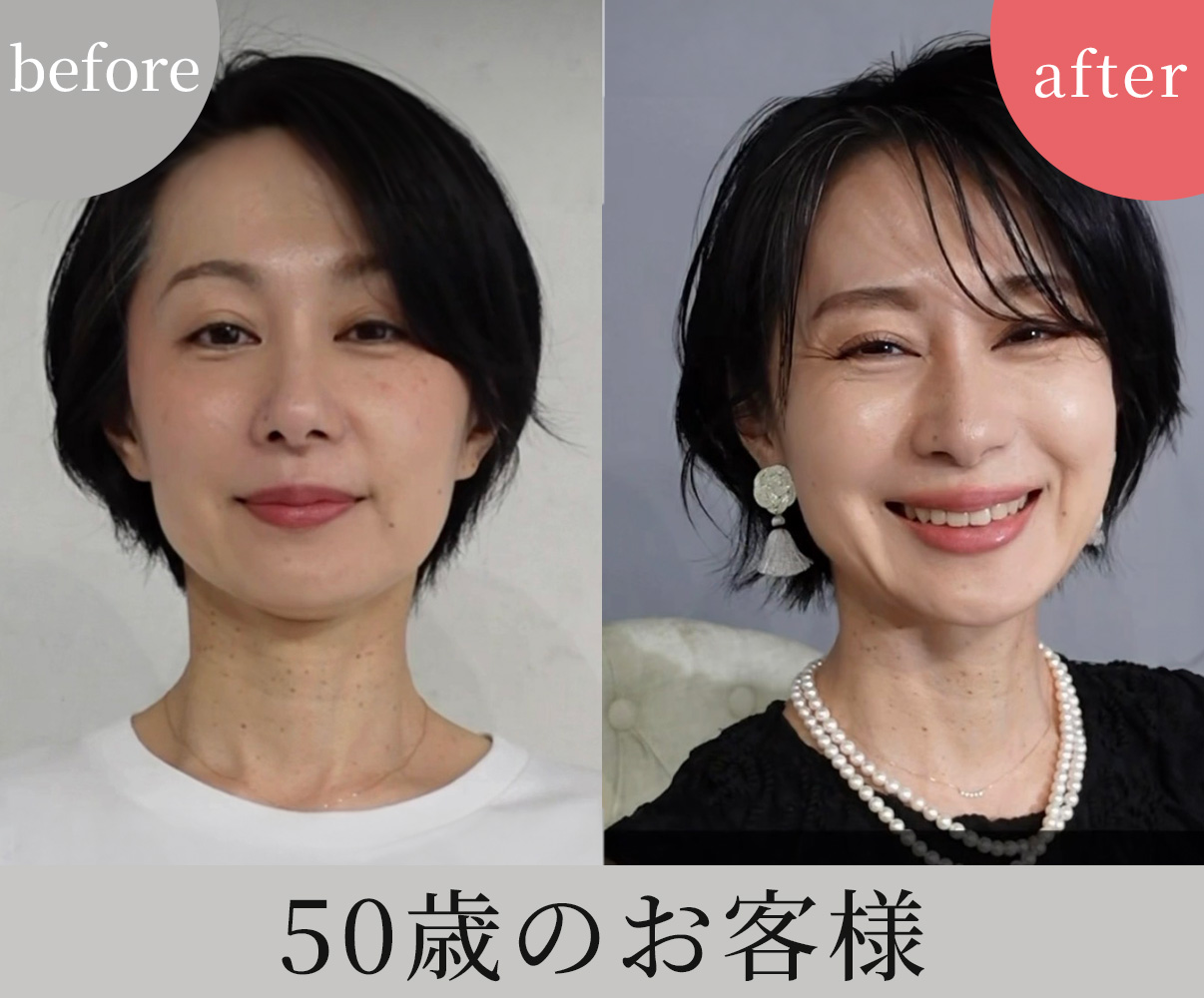 ビフォーアフター2