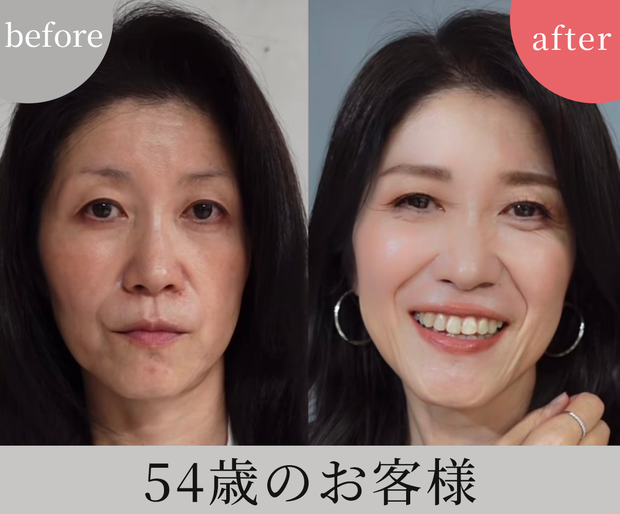 ビフォーアフター4