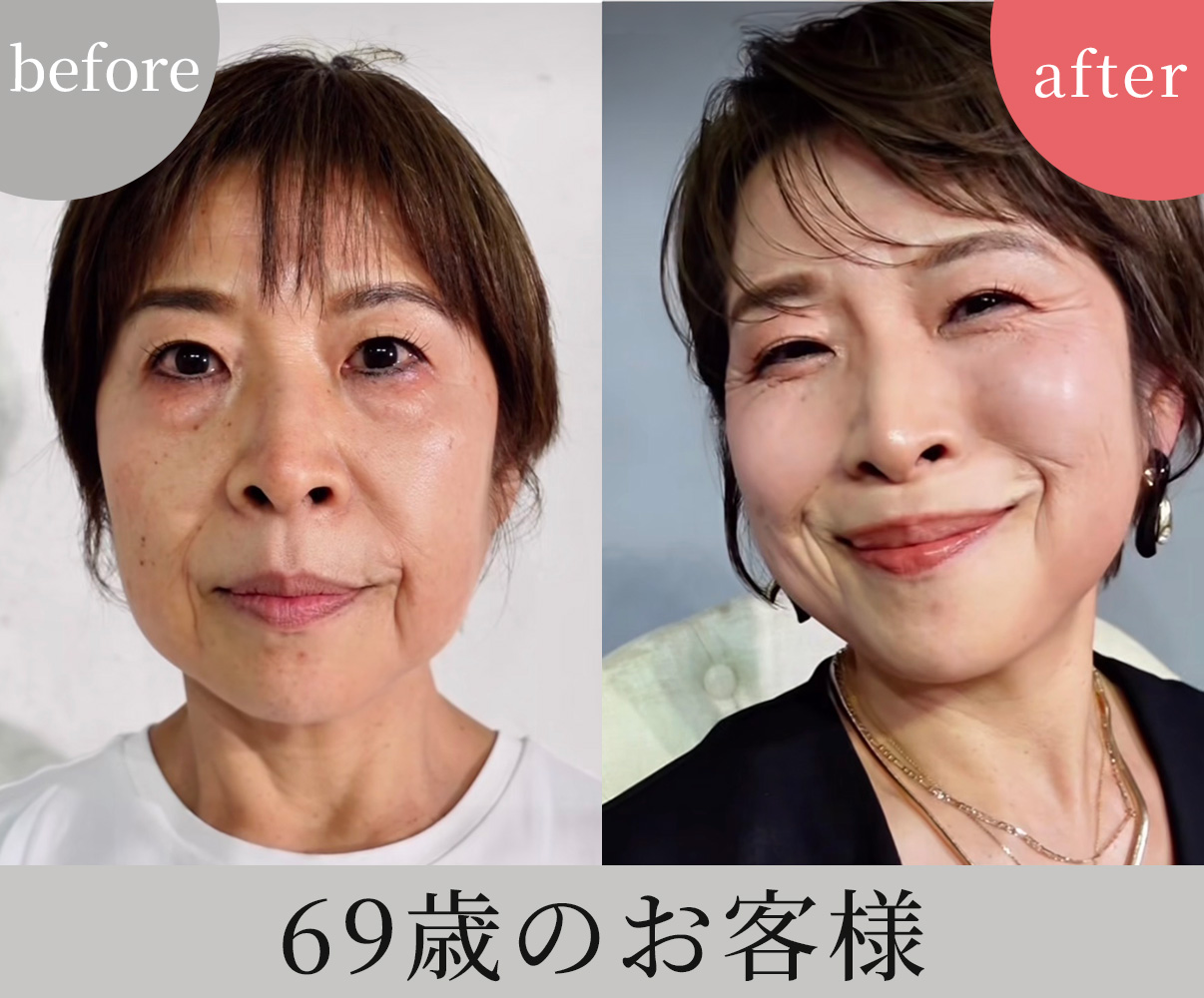 ビフォーアフター5