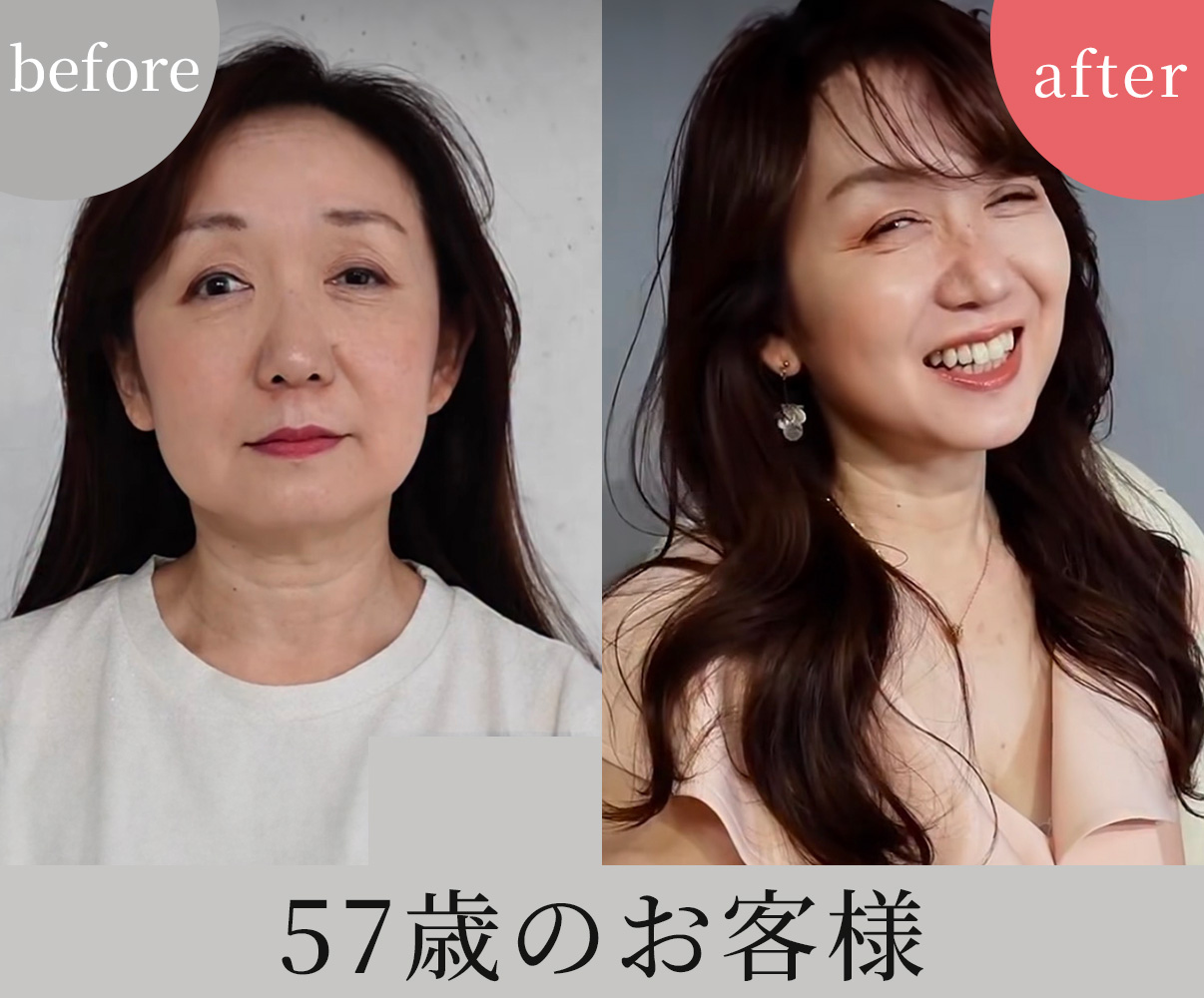 ビフォーアフター6